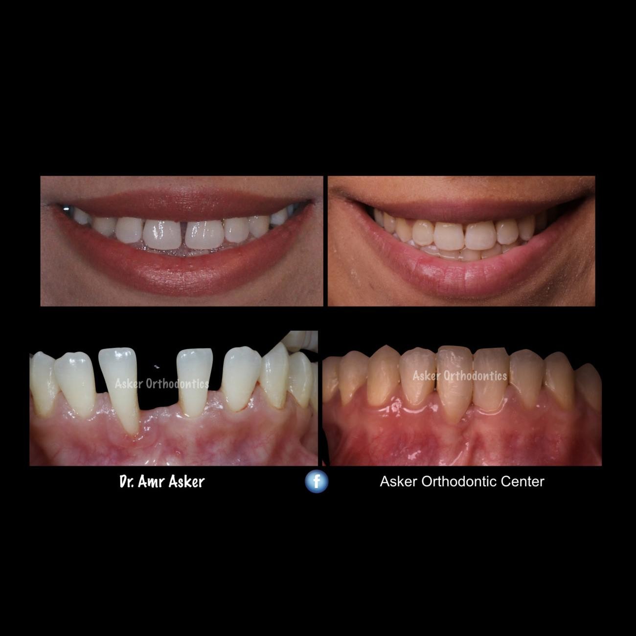 ORTHO PERIO image
